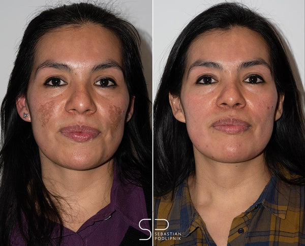 Crema Facial Radiante