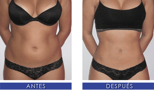 Lemme burn: Asi adelgazan las Kardashians